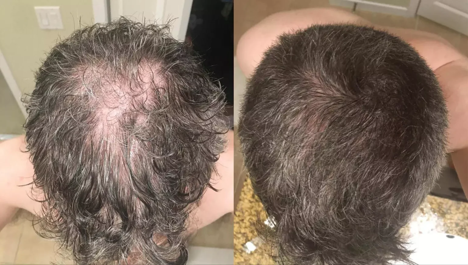 restolin before after results